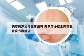天萃荷凈治療銀屑病嗎 天萃荷凈草本抑菌乳膏官方旗艦店