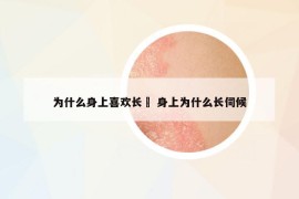 為什么身上喜歡長(zhǎng)廯 身上為什么長(zhǎng)伺候