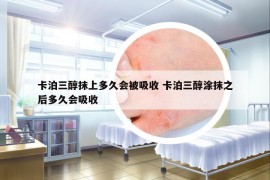 卡泊三醇抹上多久會被吸收 卡泊三醇涂抹之后多久會吸收