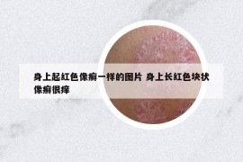 身上起紅色像癬一樣的圖片 身上長(zhǎng)紅色塊狀像癬很癢