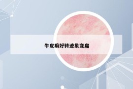 牛皮癬好轉(zhuǎn)跡象變扁