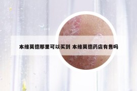 本維莫德那里可以買到 本維莫德藥店有售嗎