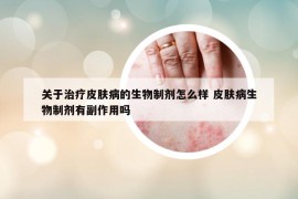 關(guān)于治療皮膚病的生物制劑怎么樣 皮膚病生物制劑有副作用嗎