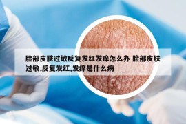 臉部皮膚過敏反復(fù)發(fā)紅發(fā)癢怎么辦 臉部皮膚過敏,反復(fù)發(fā)紅,發(fā)癢是什么病