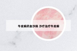 牛皮癬藥金沙揚 沙療治療牛皮癬