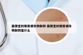 最便宜的銀屑病生物制劑 最便宜的銀屑病生物制劑是什么