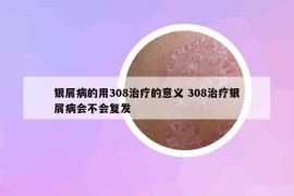 銀屑病的用308治療的意義 308治療銀屑病會不會復(fù)發(fā)