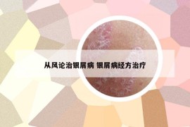 從風論治銀屑病 銀屑病經方治療