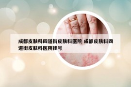 成都皮膚科四道街皮膚科醫(yī)院 成都皮膚科四道街皮膚科醫(yī)院掛號