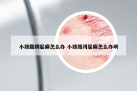 小孩胳膊起癬怎么辦 小孩胳膊起癬怎么辦啊