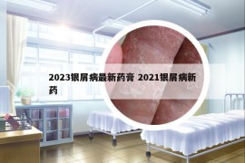 2023銀屑病最新藥膏 2021銀屑病新藥