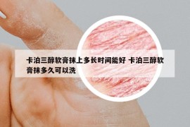 卡泊三醇軟膏抹上多長時間能好 卡泊三醇軟膏抹多久可以洗