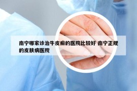南寧哪家診治牛皮癬的醫(yī)院比較好 南寧正規(guī)的皮膚病醫(yī)院