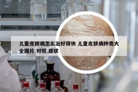 兒童皮膚病怎么治好得快 兒童皮膚病種類大全圖片 對照 癥狀
