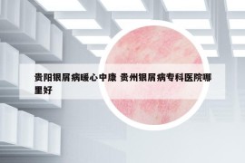 貴陽(yáng)銀屑病暖心中康 貴州銀屑病專(zhuān)科醫(yī)院哪里好