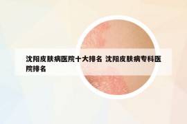 沈陽(yáng)皮膚病醫(yī)院十大排名 沈陽(yáng)皮膚病專(zhuān)科醫(yī)院排名