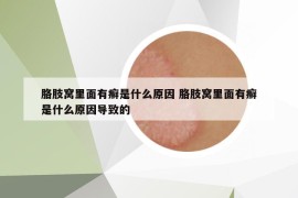 胳肢窩里面有癬是什么原因 胳肢窩里面有癬是什么原因導致的