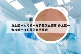 身上起一大片癬一樣的是怎么回事 身上起一大片癬一樣的是怎么回事啊