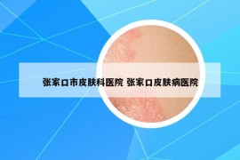 張家口市皮膚科醫(yī)院 張家口皮膚病醫(yī)院