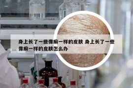 身上長(zhǎng)了一些像癬一樣的皮膚 身上長(zhǎng)了一些像癬一樣的皮膚怎么辦