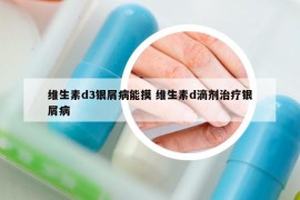 維生素d3銀屑病能摸 維生素d滴劑治療銀屑病