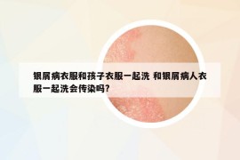 銀屑病衣服和孩子衣服一起洗 和銀屑病人衣服一起洗會(huì)傳染嗎?