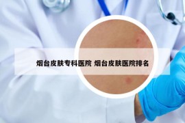 煙臺(tái)皮膚專(zhuān)科醫(yī)院 煙臺(tái)皮膚醫(yī)院排名