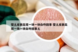 嬰兒皮膚出現(xiàn)一塊一塊白咋回事 嬰兒皮膚出現(xiàn)一塊一塊白咋回事兒