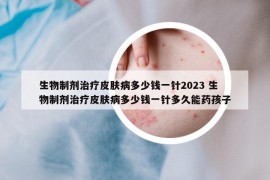 生物制劑治療皮膚病多少錢一針2023 生物制劑治療皮膚病多少錢一針多久能藥孩子