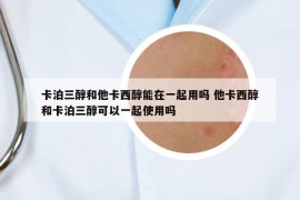 卡泊三醇和他卡西醇能在一起用嗎 他卡西醇和卡泊三醇可以一起使用嗎