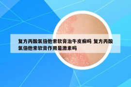 復(fù)方丙酸氯倍他索軟膏治牛皮癬嗎 復(fù)方丙酸氯倍他索軟膏作用是激素嗎