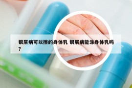 銀屑病可以擦的身體乳 銀屑病能涂身體乳嗎?