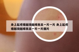 身上起疙瘩越撓越癢而且一片一片 身上起疙瘩越撓越癢而且一片一片圖片