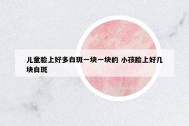 兒童臉上好多白斑一塊一塊的 小孩臉上好幾塊白斑