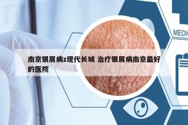 南京銀屑病z現(xiàn)代長(zhǎng)城 治療銀屑病南京最好的醫(yī)院