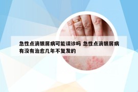 急性點滴銀屑病可能誤診嗎 急性點滴銀屑病有沒有治愈幾年不復(fù)發(fā)的