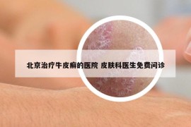 北京治療牛皮癬的醫(yī)院 皮膚科醫(yī)生免費問診