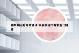 銀屑病治療專家浙江 銀屑病治療專家浙江排名