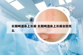 長期喝酒身上長癬 長期喝酒身上長癬會致死么