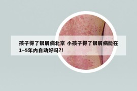 孩子得了銀屑病北京 小孩子得了銀屑病能在1~5年內(nèi)自動好嗎?!