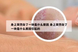 身上突然白了一塊是什么原因 身上突然白了一塊是什么原因引起的