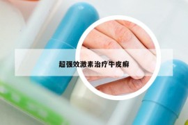超強(qiáng)效激素治療牛皮癬