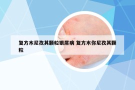 復(fù)方木尼孜其顆粒銀屑病 復(fù)方木你尼孜其顆粒