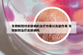 生物制劑對皮膚病的治療效果以及副作用 生物制劑治療皮膚病嗎