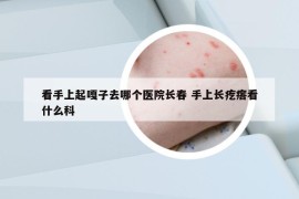 看手上起嘎子去哪個醫(yī)院長春 手上長疙瘩看什么科