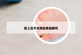 臉上出牛皮癬能敷面膜嗎