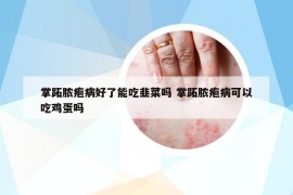 掌跖膿皰病好了能吃韭菜嗎 掌跖膿皰病可以吃雞蛋嗎