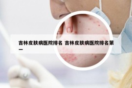 吉林皮膚病醫(yī)院排名 吉林皮膚病醫(yī)院排名第一