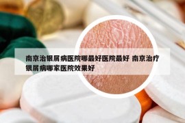 南京治銀屑病醫(yī)院哪最好醫(yī)院最好 南京治療銀屑病哪家醫(yī)院效果好
