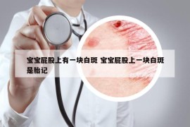 寶寶屁股上有一塊白斑 寶寶屁股上一塊白斑是胎記